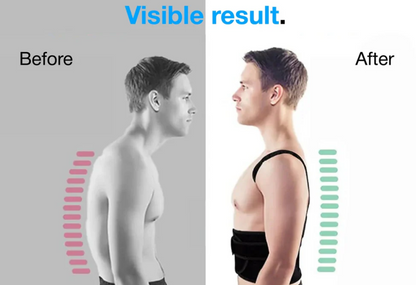 PostureMate™- The Ultimate Posture Corrector